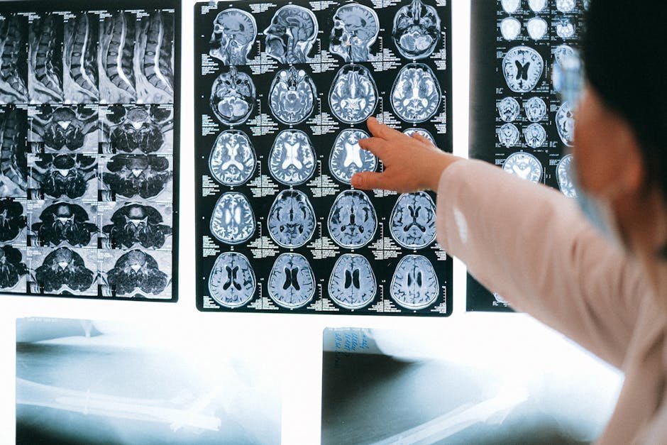 Brain MRI workstation showing white matter changes characteristic of chronic toluene exposure